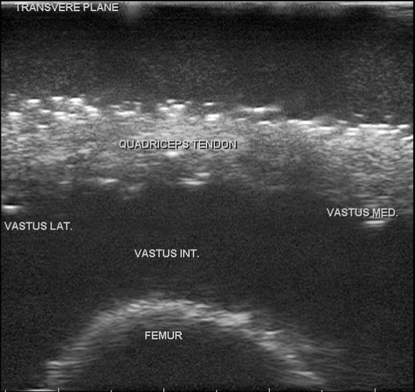 Knee Training Model MSK Knee Ultrasound Training Model – GTSimulators.com