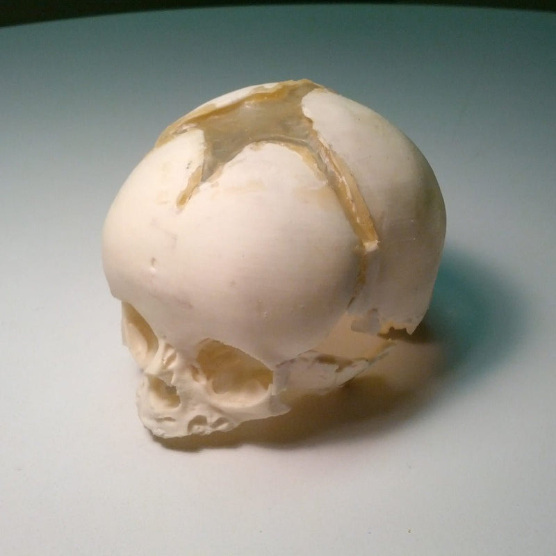 Newborn Skull Phantom for Ultrasound, MRI and CT Applications