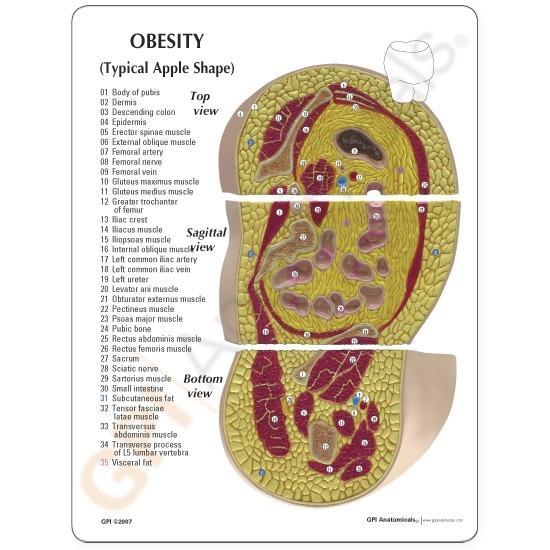 Obesity Model with Education Card