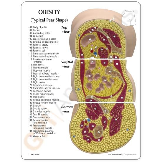 Obesity Model with Education Card