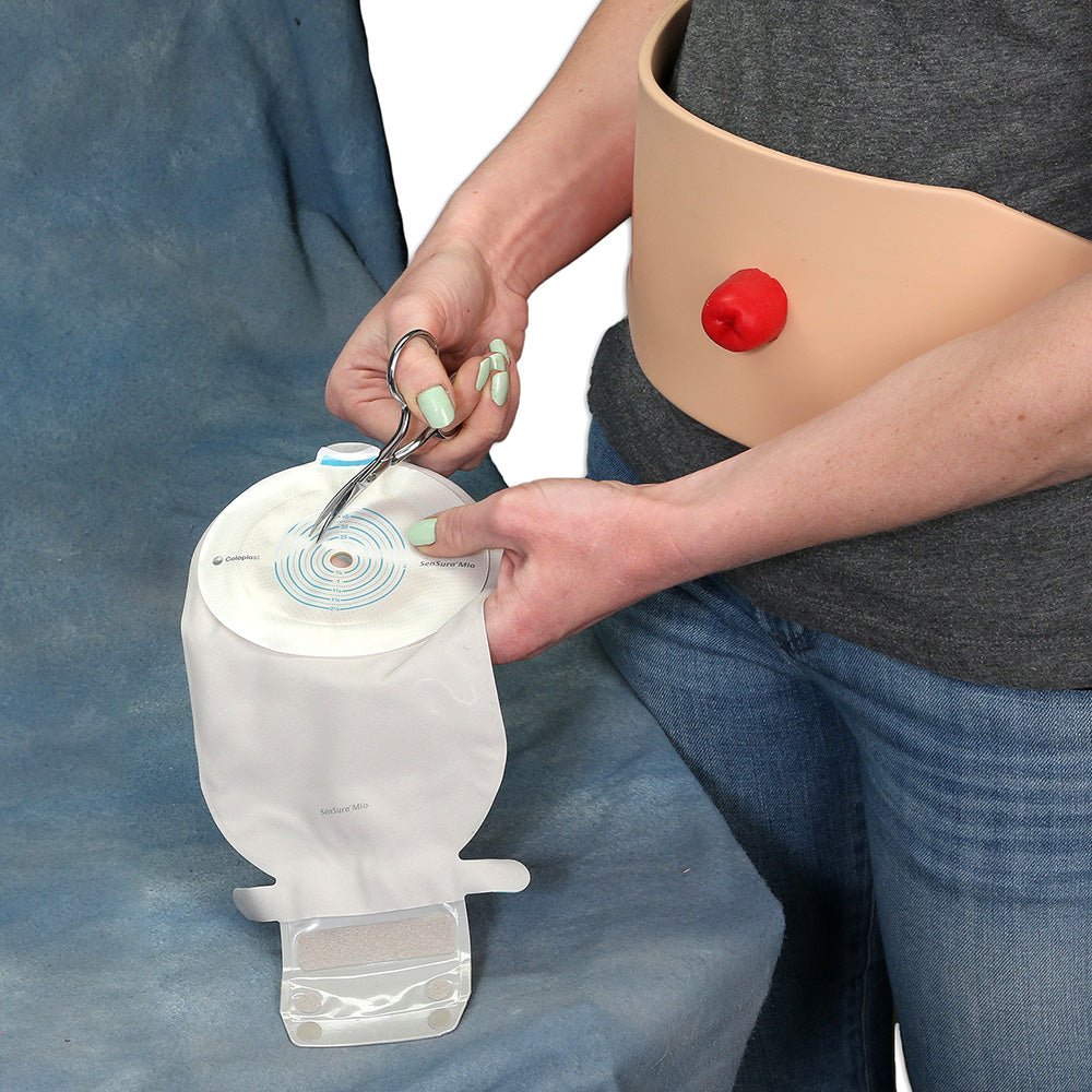 Dusky Colostomy Stoma