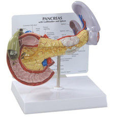 Pancreatic Cancer, Gallbladder w- Stones & Duodenal Ulcer Model