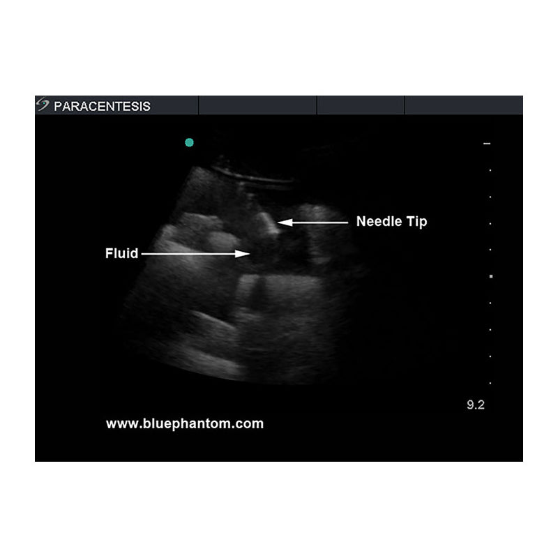 Paracentesis Ultrasound Training Model