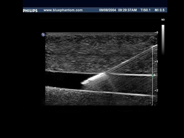 Pediatric 4 Vessel Ultrasound Training Block