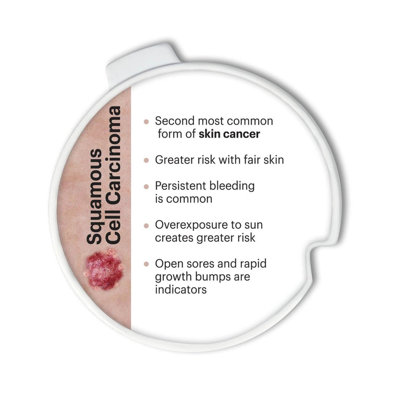 Precancerous and Cancerous Skin Lesions