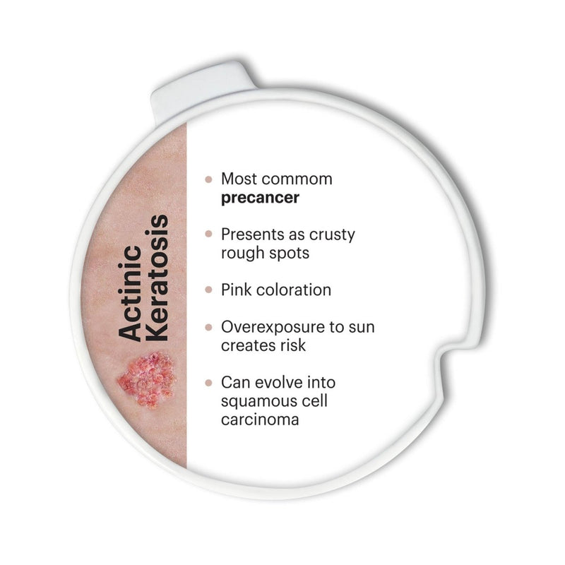 Precancerous and Cancerous Skin Lesions