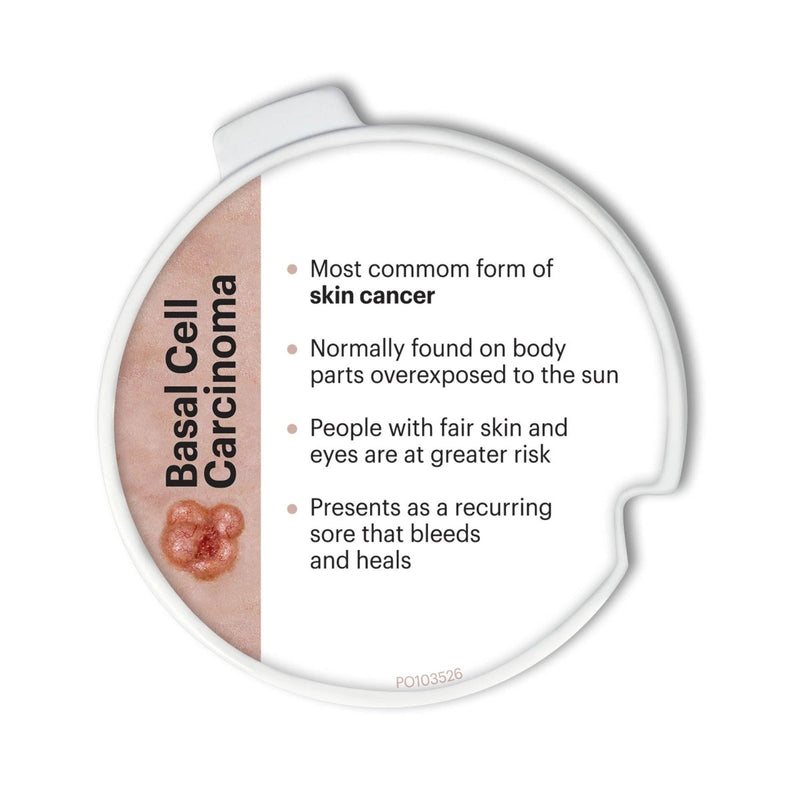 Precancerous and Cancerous Skin Lesions