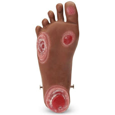 Pressure Ulcer Foot for GERi™-KERi™, Medium Skin