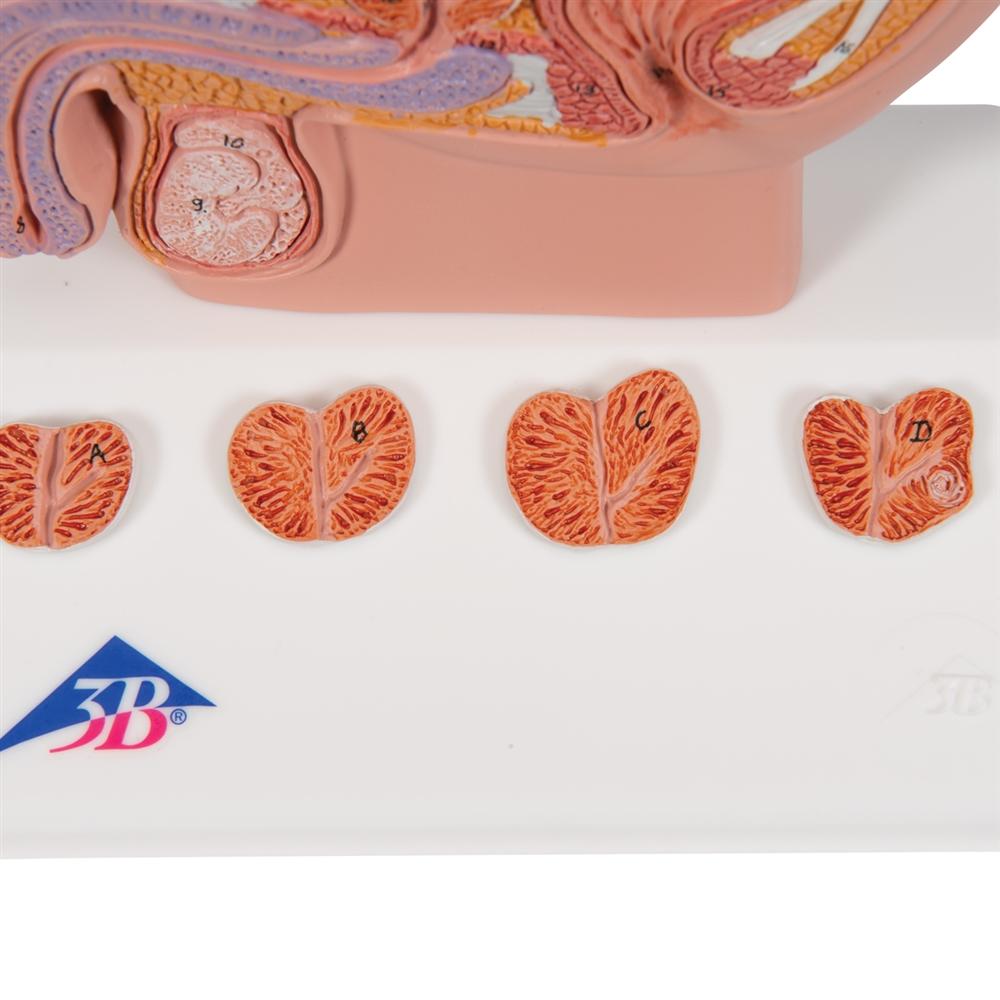 Prostate Simulators Prostate Model, 1-2 natural size – GTSimulators.com