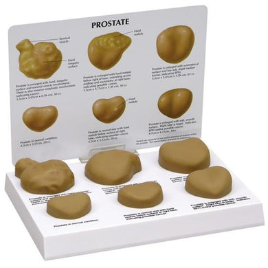 Prostate Simulators Prostate Examination – Tagged