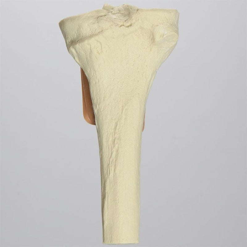 Proximal Tibia with Skin Patch for SB151713