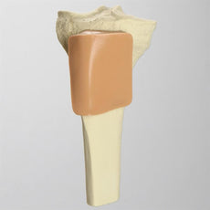 Proximal Tibia with Skin Patch for SB151713