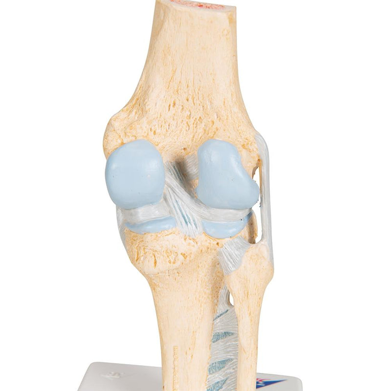 Sectional knee joint model, 3-part