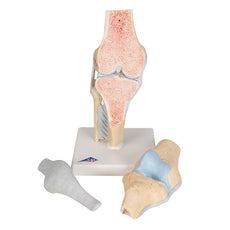 Sectional knee joint model, 3-part