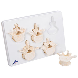 Set of 5 lumbar Vertebrae Model
