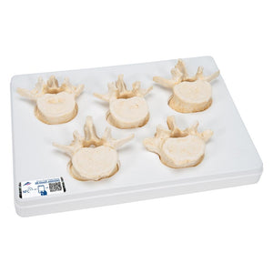 Set of 5 lumbar Vertebrae Model