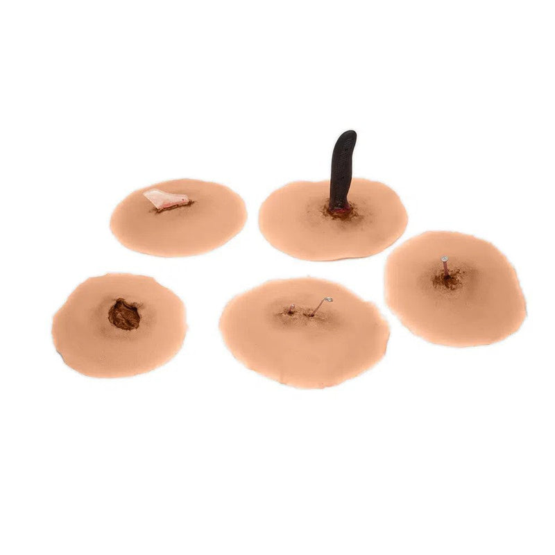 Set Of 5 Sticky Wounds With Foreign Body