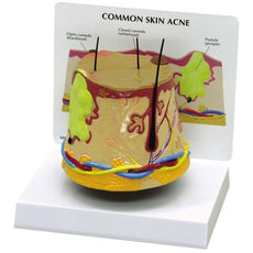 Skin Acne (oversize) Model