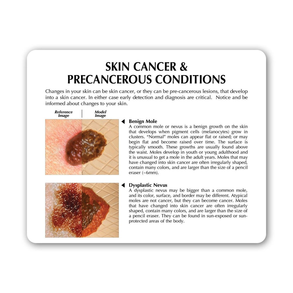 Modeling Skin Death Skin Cancer Model – GTSimulators.com