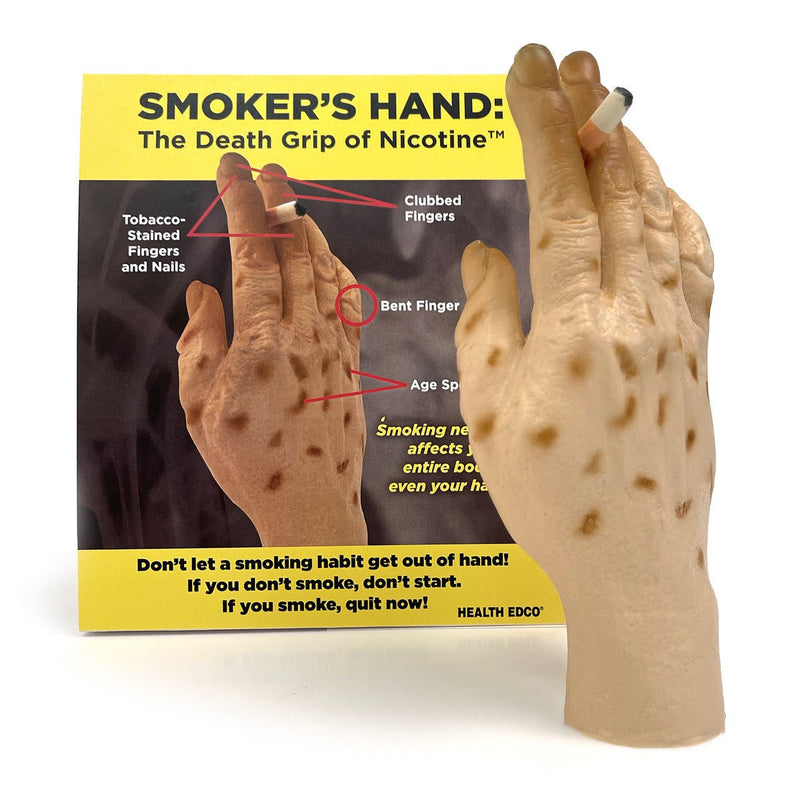 Smoker’s Hand: The Death Grip Of Nicotine™ Model