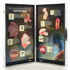 Smoking Consequences 3D Display