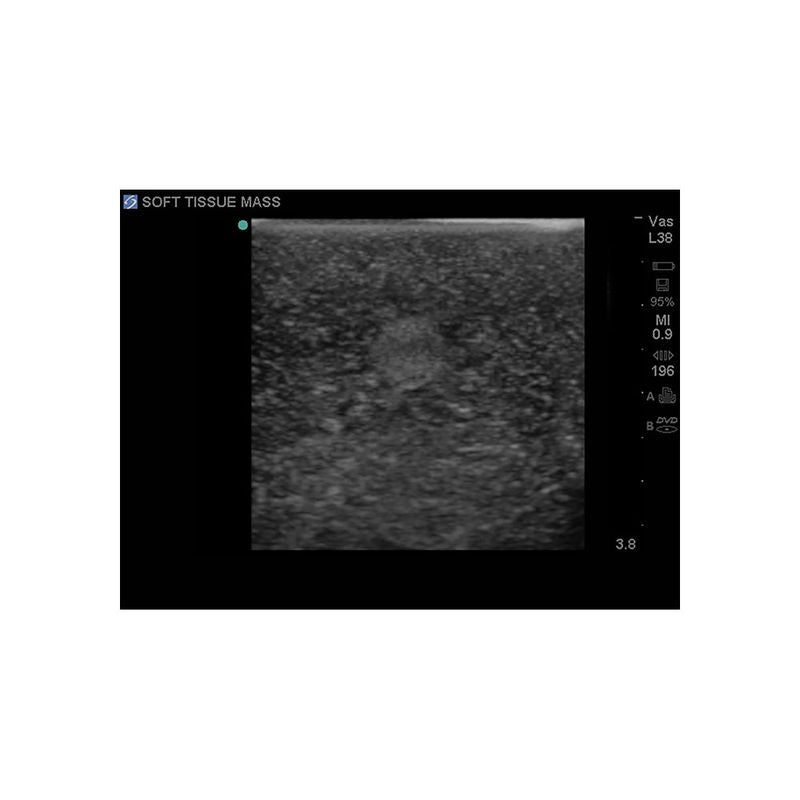 Soft Tissue Masses Ultrasound Training Model, Leg