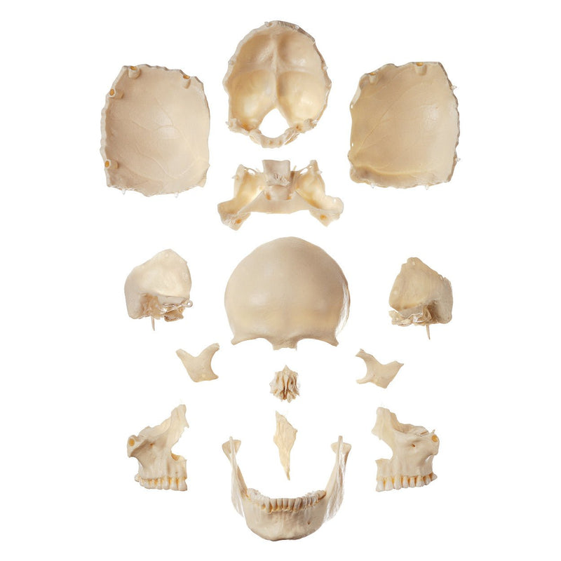 SOMSO 14-Piece Model of the Skull