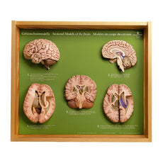 SOMSO 5 Section Models of the Brain