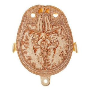 SOMSO Anatomical Section Model of the Head (Combined with corresponding MR-Figures)