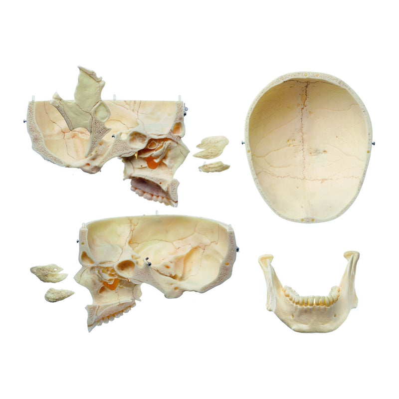 SOMSO Artificial Human Skull - 9 Parts