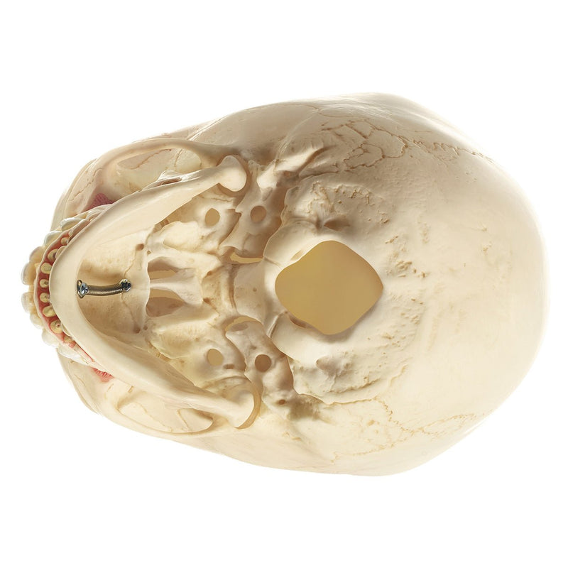 SOMSO Artificial Skull of Child About 6 Years Old - 2 parts