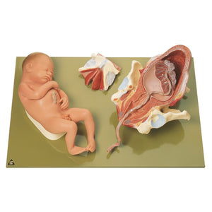 SOMSO Birth - Third Stage