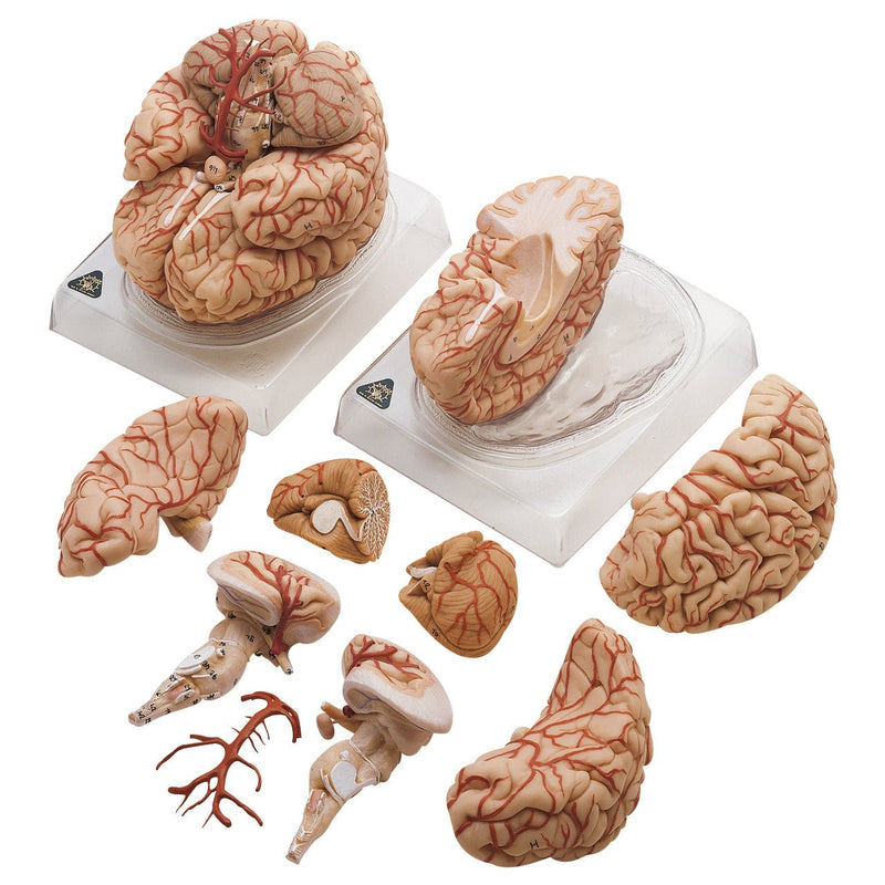 SOMSO Brain Model with Arteries