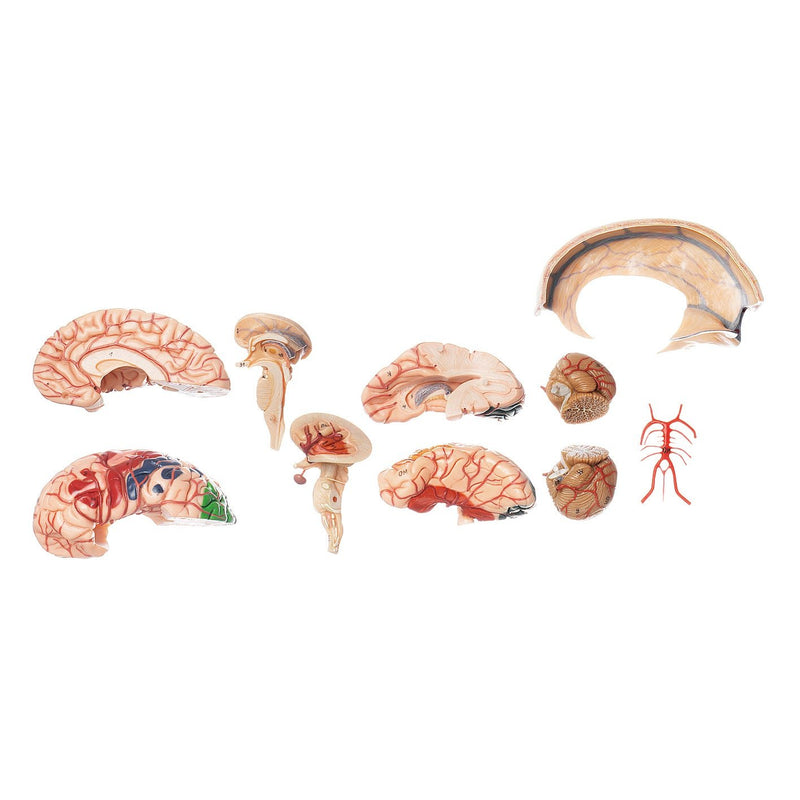 SOMSO Brain Model with Dura Mater and Falx Cerebri, 10 Parts