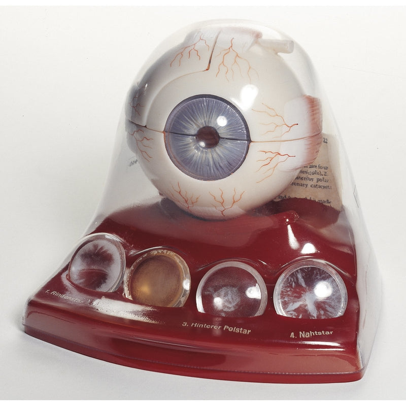 SOMSO Cataract Eye Model