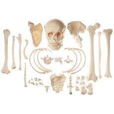 SOMSO Collection of Typical Human Bones