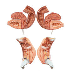 SOMSO Female Genital Organs w- Removable Median Section