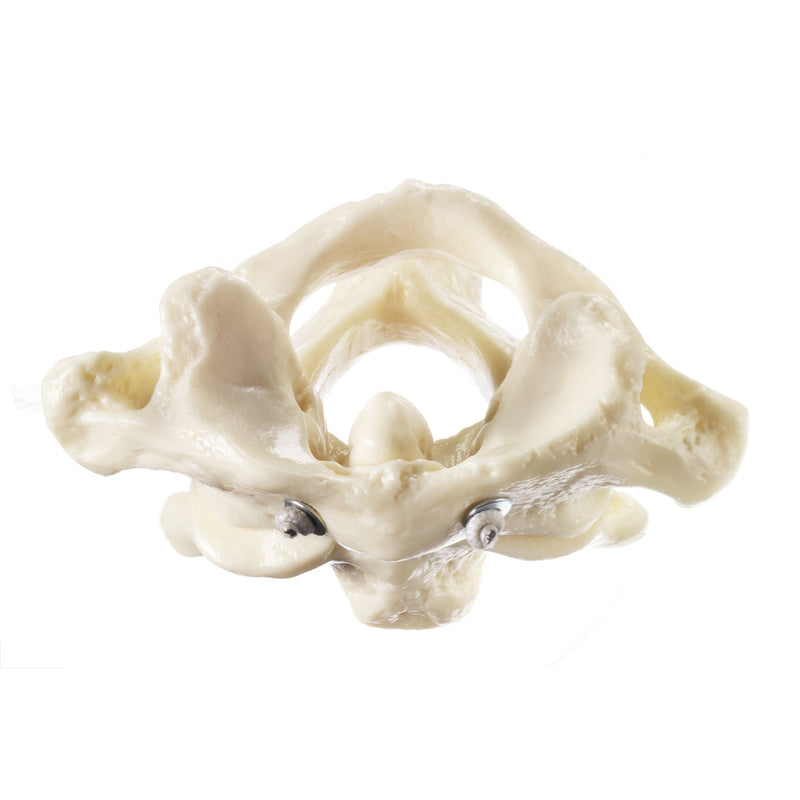 SOMSO First and Second Cervical Vertebrae (Atlas and axis)
