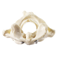SOMSO First and Second Cervical Vertebrae (Atlas and axis)