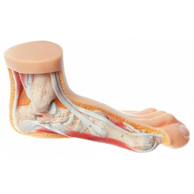 SOMSO Hallux Valgus Model
