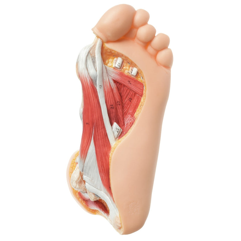 SOMSO Hallux Valgus Model
