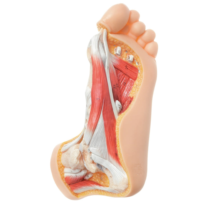 SOMSO Hallux Valgus Model
