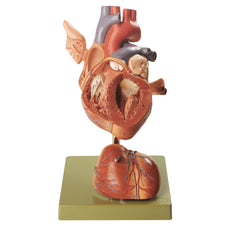 SOMSO Heart - 1 1-2 Times Natural Size