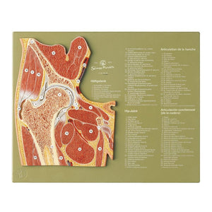 SOMSO Hip Joint Section Model