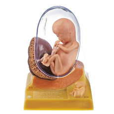 SOMSO Human Embryo in the Third Month