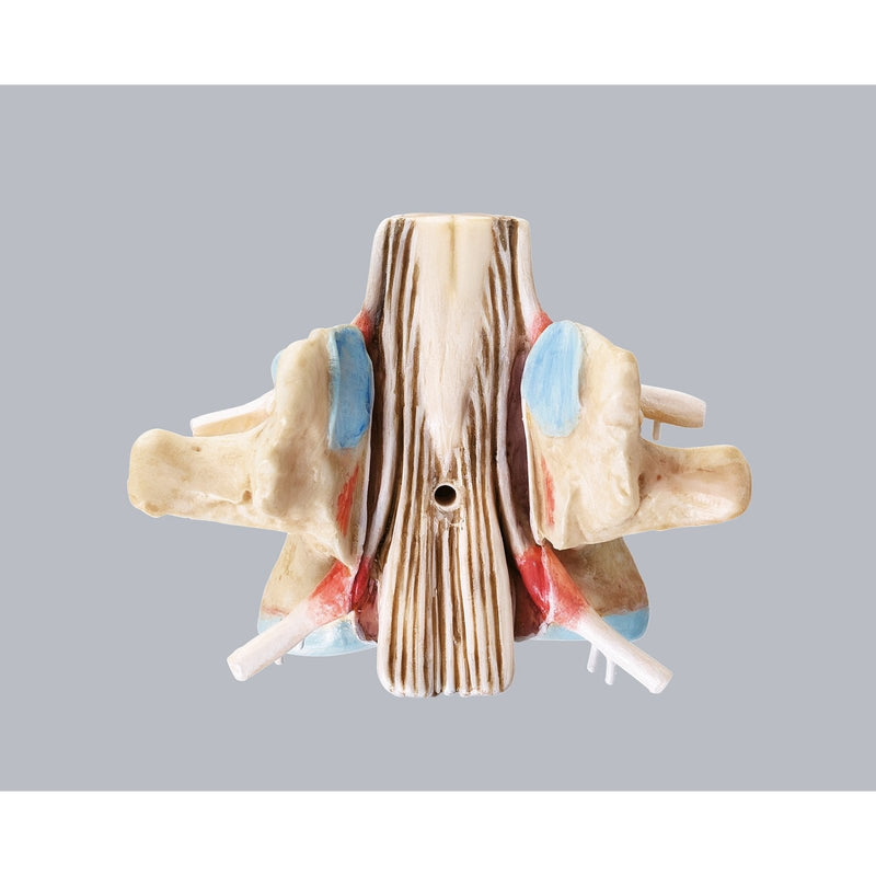 SOMSO Lumbar Vertebra (L-2) with Lumbar Region of Spinal Cord