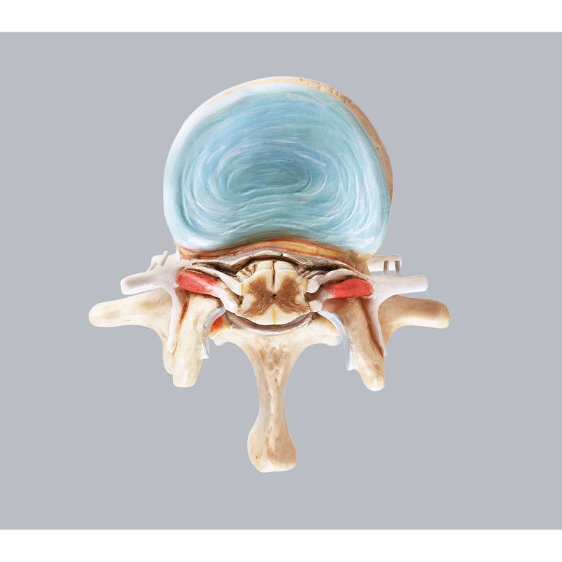 SOMSO Lumbar Vertebra (L-2) with Lumbar Region of Spinal Cord
