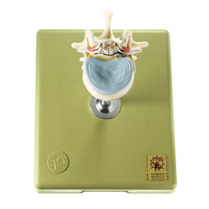 SOMSO Lumbar Vertebra (L-2) with Lumbar Region of Spinal Cord