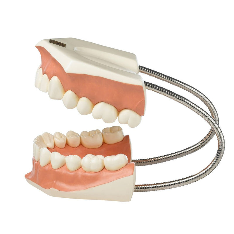 SOMSO Model of a Set of Teeth