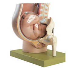 SOMSO Pelvis w- Uterus in Ninth Month Pregnancy w- femoral head